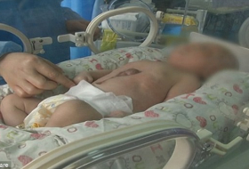 Astonishing footage shows baby`s heart beating OUTSIDE his body